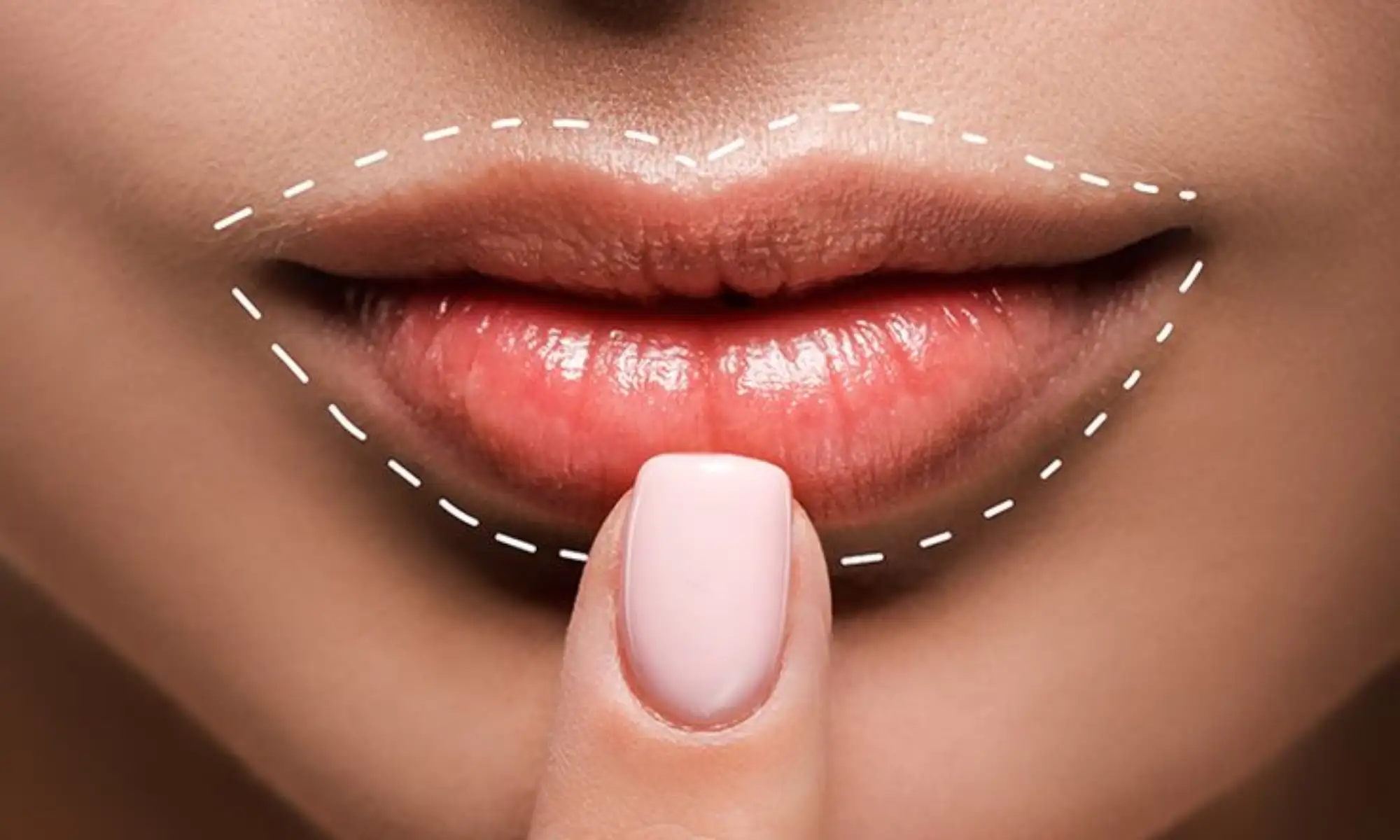 Lip Plumping Treatment