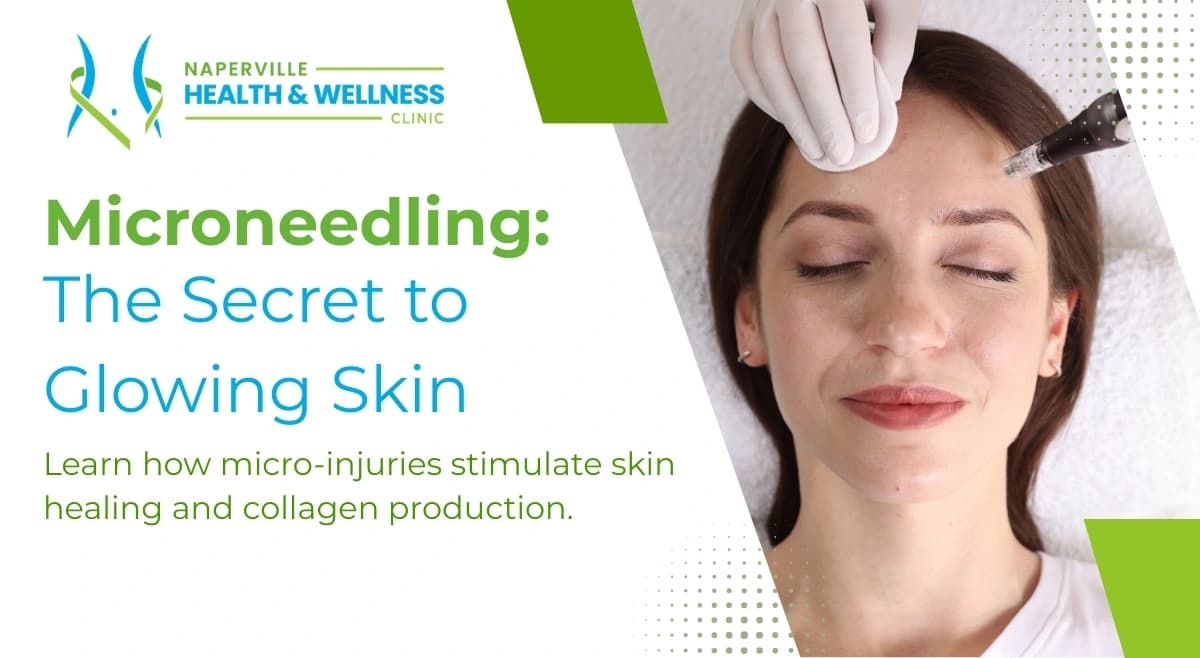 Woman receiving microneedling treatment on her forehead for glowing skin, advertised by Naperville Health & Wellness Clinic.