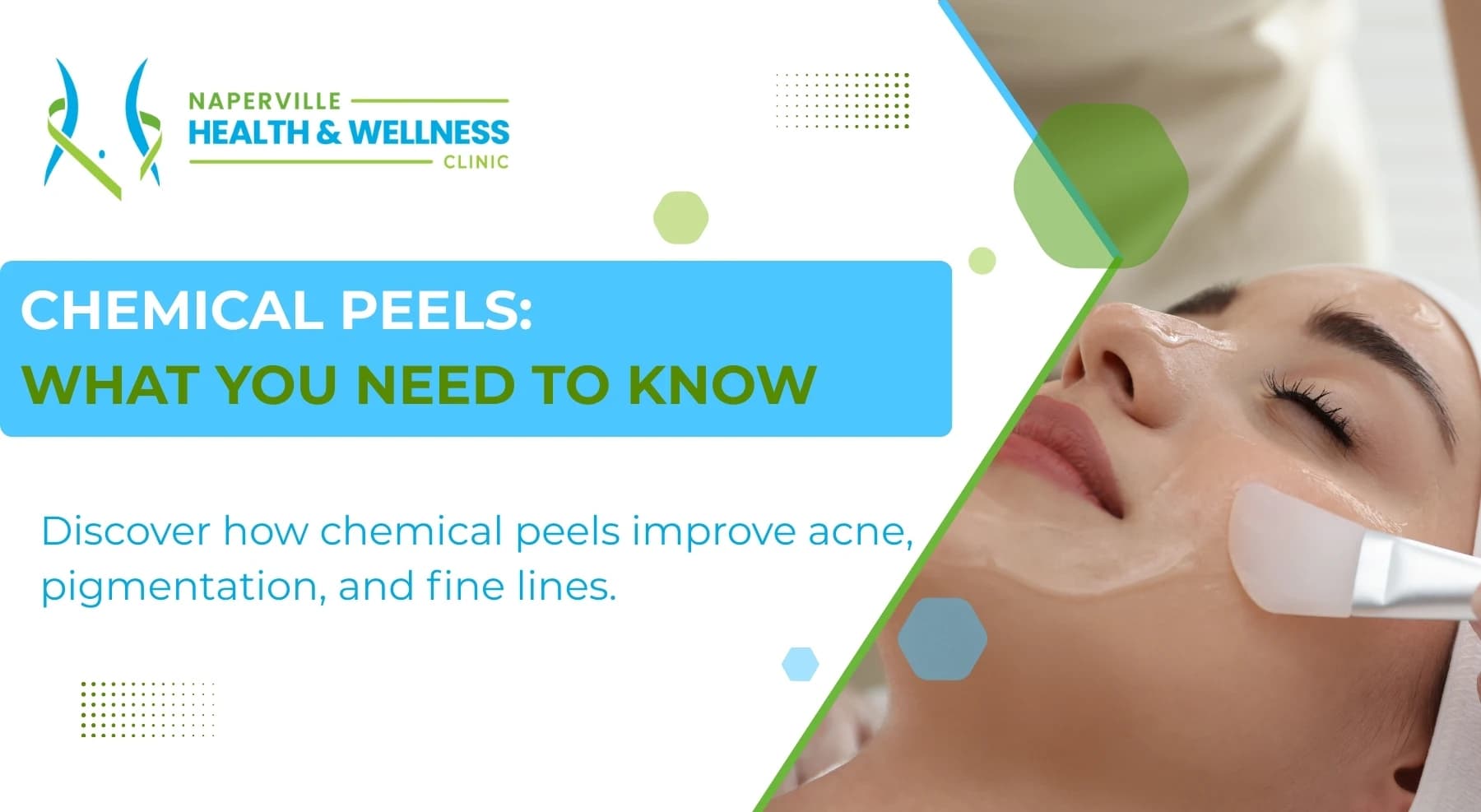 Promotional image for chemical peels, showing a woman receiving a facial treatment and clinic branding.